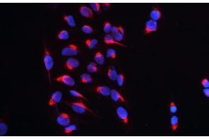 IF analysis of CARS using anti-CARS antibody (ABIN5692995) CARS was detected in immunocytochemical section of U20S cell. (CARS 抗体  (AA 510-748))