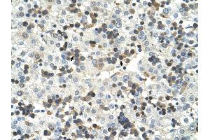 HSD17B6 antibody was used for immunohistochemistry at a concentration of 4-8 ug/ml to stain Hemopoietic cells (arrows) in Human Liver. (HSD17B6 抗体  (N-Term))