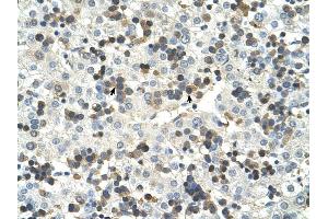 HSD17B6 antibody was used for immunohistochemistry at a concentration of 4-8 ug/ml to stain Hemopoietic cells (arrows) in Human Liver. (HSD17B6 抗体  (N-Term))