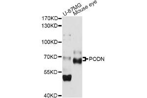 Western blot analysis of extracts of various cell lines, using PODN antibody (ABIN6290800) at 1:1000 dilution. (Podocan 抗体)