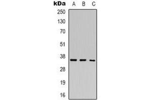 Western blot analysis of HEY2 expression in A549 (A), MCF7 (B), K562 (C) whole cell lysates. (HEY2 抗体)