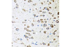 Immunohistochemistry of paraffin-embedded mouse brain using ACVR1C antibody at dilution of 1:100 (40x lens). (ACVR1C/ALK7 抗体)