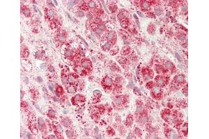 Immunohistochemistry (Paraffin-embedded Sections) (IHC (p)) image for anti-Solute Carrier Family 16, Member 11 (Monocarboxylic Acid Transporter 11) (SLC16A11) (AA 48-76), (N-Term) antibody (ABIN654868)