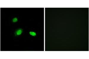 Immunofluorescence analysis of A549 cells, using HSPB2 Antibody. (HSPB2 抗体  (AA 121-170))