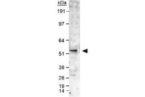 Western blot analysis of CYP19A1 in human fetal temporal lobe lysate using CYP19A1 polyclonal antibody . (Aromatase 抗体  (AA 400-502))