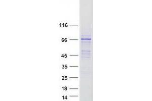 Western Blotting (WB) image for Family with Sequence Similarity 83, Member D (FAM83D) protein (Myc-DYKDDDDK Tag) (ABIN2720860)
