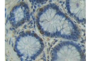 Detection of ITGaD in Human Rectum Tissue using Polyclonal Antibody to Integrin Alpha D (ITGaD) (ITGAD 抗体  (AA 879-1099))