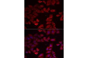 Immunofluorescence analysis of HeLa cell using SEPHS1 antibody. (SEPHS1 抗体)