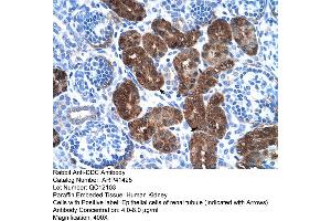 Rabbit Anti-DDC Antibody  Paraffin Embedded Tissue: Human Kidney Cellular Data: Epithelial cells of renal tubule Antibody Concentration: 4. (DDC 抗体  (N-Term))
