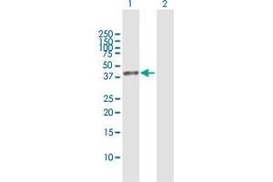 Western Blotting (WB) image for anti-Acetyl-CoA Acetyltransferase 2 (ACAT2) (AA 1-397) antibody (ABIN513061)