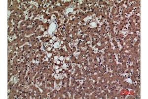 Immunohistochemistry (IHC) analysis of paraffin-embedded Human Liver, antibody was diluted at 1:100. (PSG1 抗体  (Internal Region))