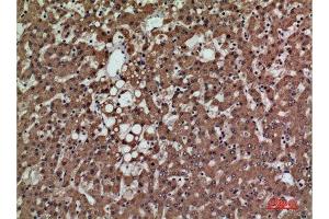 Immunohistochemistry (IHC) analysis of paraffin-embedded Human Liver, antibody was diluted at 1:100. (PSG1 抗体  (Internal Region))
