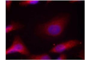 Image no. 3 for anti-Nuclear Receptor Coactivator 1 (NCOA1) (pTyr529) antibody (ABIN196876) (NCOA1 抗体  (pTyr529))