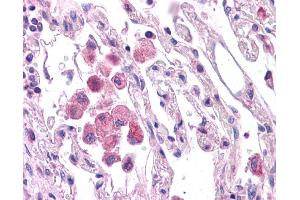 HNF1A antibody was used for immunohistochemistry at a concentration of 4-8 ug/ml. (HNF1A 抗体  (N-Term))