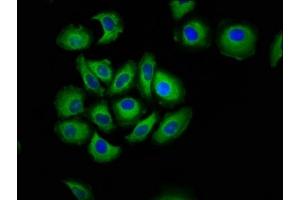 Immunofluorescence staining of A549 cells with ABIN7146237 at 1:133, counter-stained with DAPI. (Cadherin 7 抗体  (AA 146-296))