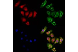 ABIN6259127 and ABIN6273829 staining HepG2 cells by IF/ICC.