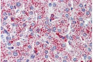 Human Liver (formalin-fixed, paraffin-embedded) stained with SP4 antibody ABIN462207 followed by biotinylated goat anti-rabbit IgG secondary antibody ABIN481713, alkaline phosphatase-streptavidin and chromogen. (SP4 抗体  (C-Term))