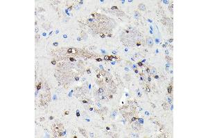 Immunohistochemistry of paraffin-embedded mouse brain using NMDA Rabbit mAb (ABIN7267420) at dilution of 1:100 (40x lens). (NMDAR2A 抗体)