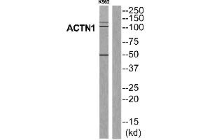 Western blot analysis of extracts from K562 cells, using ACTN1 antibody. (ACTN1 抗体  (N-Term))