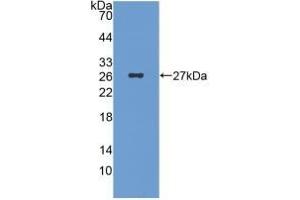 Detection of Recombinant ICA1, Human using Monoclonal Antibody to Islet Cell Autoantigen 1 (ICA1) (ICA1 抗体  (AA 1-258))