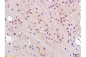 Formalin-fixed and paraffin embedded rat brain tissue labeled with Anti FBXW7/CDC4 Polyclonal Antibody, Unconjugated (ABIN1386103) at 1:200 followed by conjugation to the secondary antibody and DAB staining. (FBXW7 抗体  (AA 501-600))