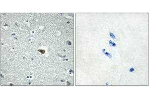 Immunohistochemistry analysis of paraffin-embedded human brain tissue, using BAI1 Antibody. (BAI1 抗体  (AA 691-740))
