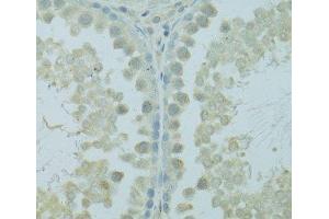 Immunohistochemistry of paraffin-embedded Rat testis using HUS1B Polyclonal Antibody at dilution of 1:100 (40x lens). (HUS1B 抗体)