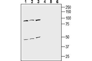Western blot analysis of mouse Neuro-2a neuroblastoma cell line lysate (lanes 1 and 4), human SH-SY5Y neuroblastoma cell line lysate (lanes 2 and 5) and human  monocytic leukemia cell line lysate (lanes 3 and 6):1-3.