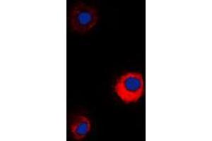 Immunofluorescent analysis of MUC13 staining in KNRK cells. (MUC13 抗体  (C-Term))