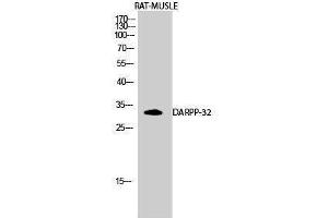Western Blotting (WB) image for anti-Protein Phosphatase 1, Regulatory (Inhibitor) Subunit 1B (PPP1R1B) (Tyr785) antibody (ABIN3180011) (DARPP32 抗体  (Tyr785))