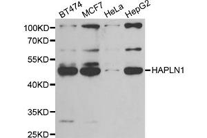 Western blot analysis of extracts of various cell lines, using HAPLN1 antibody. (HAPLN1 抗体)
