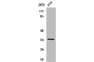 Western Blot analysis of K562 cells using CA VA Polyclonal Antibody (CA5A 抗体  (Internal Region))