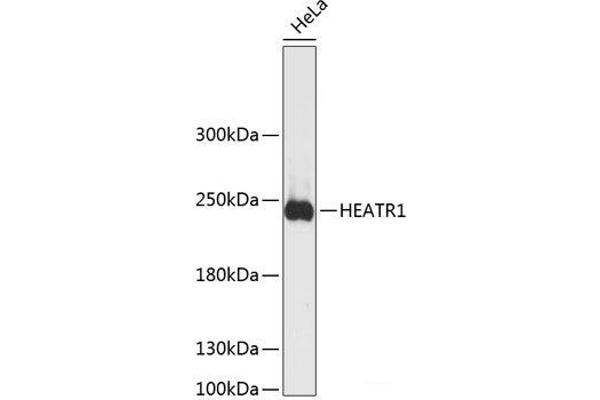 HEATR1 抗体