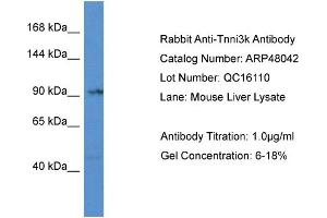 Western Blotting (WB) image for anti-TNNI3 Interacting Kinase (TNNI3K) (Middle Region) antibody (ABIN2783203) (TNNI3K 抗体  (Middle Region))