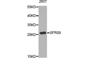 Western blot analysis of extracts of 293T cell line, using SFRS9 antibody. (SFRS9 抗体)