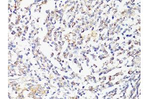 Immunohistochemistry of paraffin-embedded human tonsil using MTOR antibody (ABIN6292920) at dilution of 1:150 (40x lens). (MTOR 抗体)