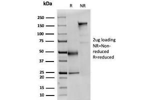 SDS-PAGE Analysis Purified Fodrin Mouse Monoclonal Antibody (SPTAN1/3351). (SPTAN1 抗体  (AA 2351-2475))