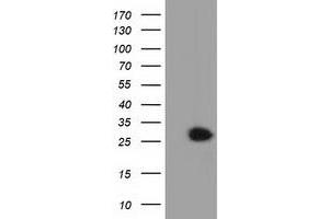 Western Blotting (WB) image for anti-Glutathione S-Transferase theta 2 (GSTT2) antibody (ABIN1498559) (GSTT2 抗体)