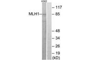 Western blot analysis of extracts from K562 cells, using MLH1 Antibody. (MLH1 抗体  (AA 441-490))