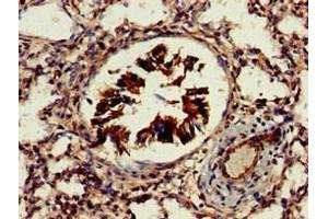 Immunohistochemistry of paraffin-embedded human lung tissue using ABIN7164755 at dilution of 1:100 (PRAS40 抗体  (AA 52-101))