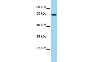 WB Suggested Anti-ANKS1B Antibody Titration: 1. (ANKS1B 抗体  (C-Term))