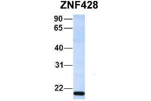Host:  Rabbit  Target Name:  ZNF428  Sample Type:  293T  Antibody Dilution:  1. (ZNF428 抗体  (Middle Region))