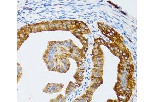 Immunohistochemistry of paraffin-embedded Rat fallopian tube using CHAF1B Polyclonal Antibody at dilution of 1:100 (40x lens). (CHAF1B 抗体)