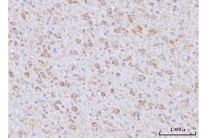 IHC analysis of RAP1GAP using anti-RAP1GAP antibody (ABIN7599729). (RAP1GAP 抗体  (AA 11-661))