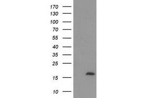 Western Blotting (WB) image for anti-Chromosome 2 Open Reading Frame 40 (C2orf40) antibody (ABIN1497048) (C2orf40 抗体)