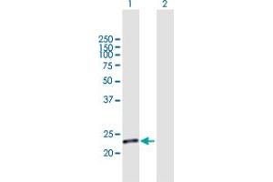 Western Blot analysis of C19orf80 expression in transfected 293T cell line by C19orf80 MaxPab polyclonal antibody. (C19ORF80 抗体  (AA 1-251))