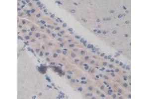 Used in DAB staining on fromalin fixed paraffin- embedded Kidney tissue (KERA 抗体  (AA 21-292))