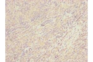 Immunohistochemistry of paraffin-embedded human tonsil tissue using ABIN7147374 at dilution of 1:100 (CEP57L1 抗体  (AA 1-167))