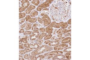 Immunohistochemical analysis of B on paraffin-embedded Human kidney tissue. (WDR41 抗体  (C-Term))