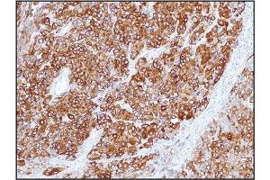 Immunohistochemistry (IHC) image for anti-Melan A (MLANA) (C-Term) antibody (ABIN5611398)